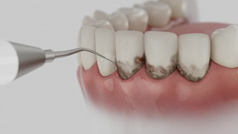 Reliable Emergency Dentist contractor in Cameron, MO by Smile Center Dentistry